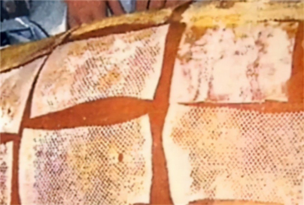 死法最惨的日本人核辐射后想安乐死却被医生强行续命83天