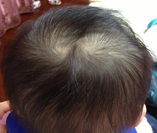 最后,关于谚语里的头旋代表性格也是不存在,若是头