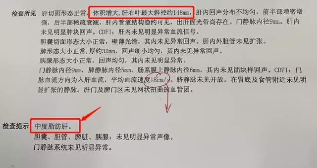 结果做完b超后,医生愣了:影像结果显示中度脂肪肝,肝脏右叶最大斜径