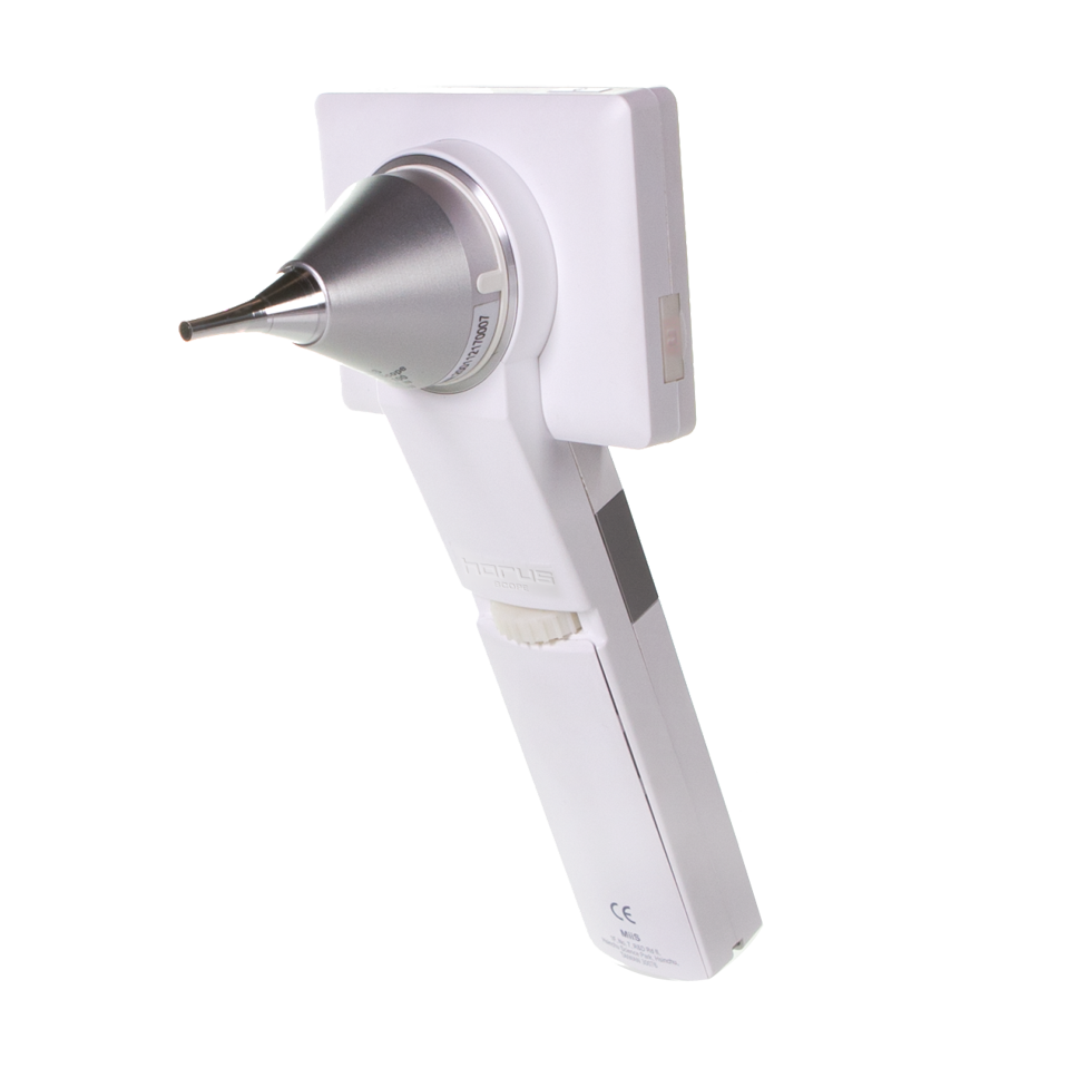 可视大屏幕耳窥镜61 数码掌上医疗影像技术,提供创新产品解决方案