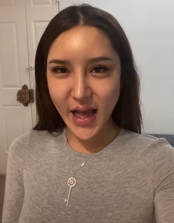 女网红自曝整容上百次,曾靠插管维持呼吸,嘴唇肿成嘟嘟唇_腾讯新闻