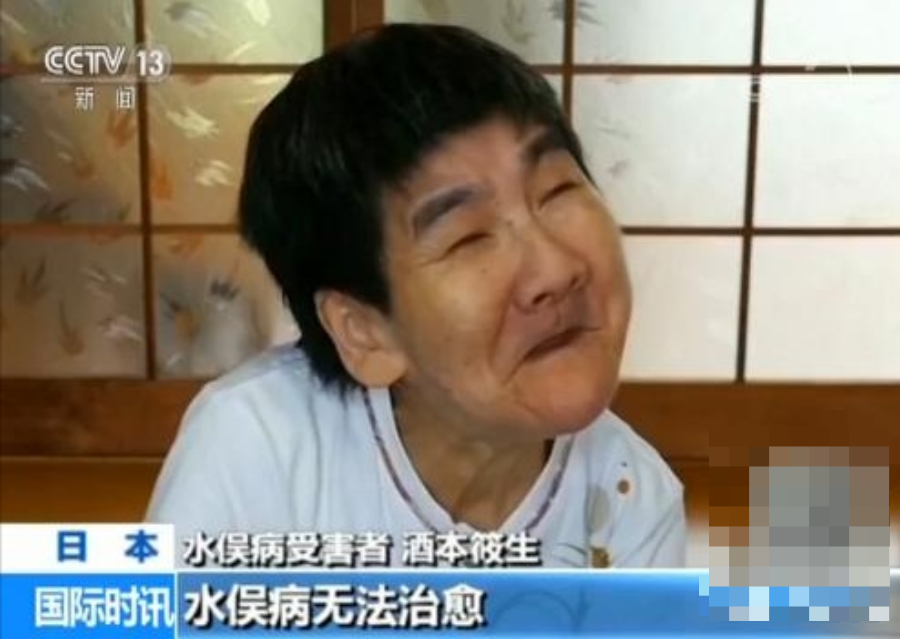 日本闯的祸凭什么要全球一起承担核辐射里的悲惨你了解多少