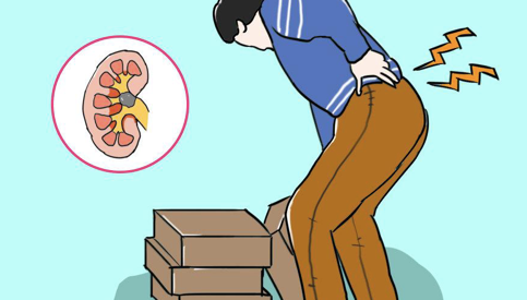 腰疼还是肾疼医生1招教你分辨