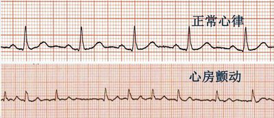 喜报市五院获授国家标准化房颤中心建设单位