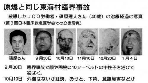 当年因捡了来历不明"钥匙链",失去双腿左臂的宋学文,后来怎样