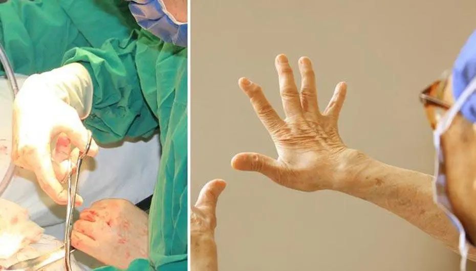 肝胆两相照,不老柳叶刀丨痛悼"中国肝胆外科之父"吴孟超院士