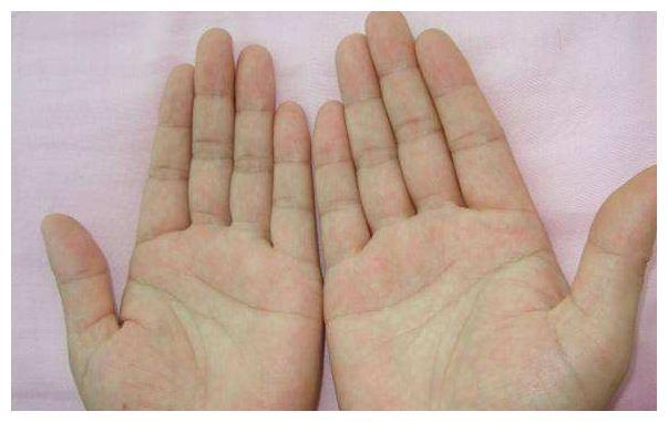 事实上,许多成功的男人确实有断掌,但是他们应该和其他纹路区别对待.