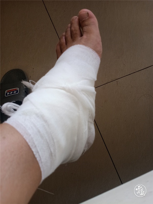 保通的第一线,一名辅警在大保高速公路巡逻途中被落石砸中脚踝受伤,他