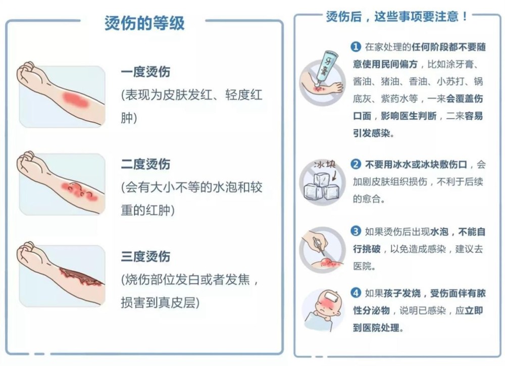 油烫水泡不挑破会自己消吗_烫挑水泡消破油会留疤吗_烫水泡挑破皮要去掉吗