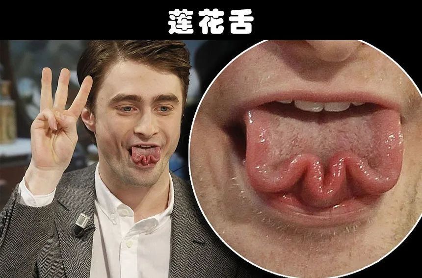 6,莲花舌舌头对每一个人来说都是非常重要的身体器官,它可以帮助我们