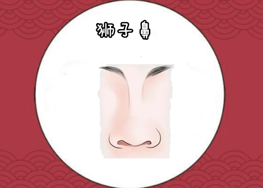 狮子鼻所谓的狮子鼻,就是指一个人的鼻子长的肥厚有肉,鼻翼圆润,中间