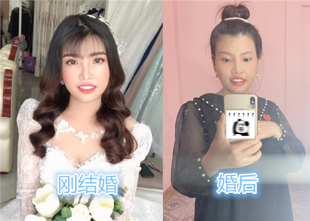 女子因太丑遭嫌弃整容后与富商闪婚如今孕期又回到原形