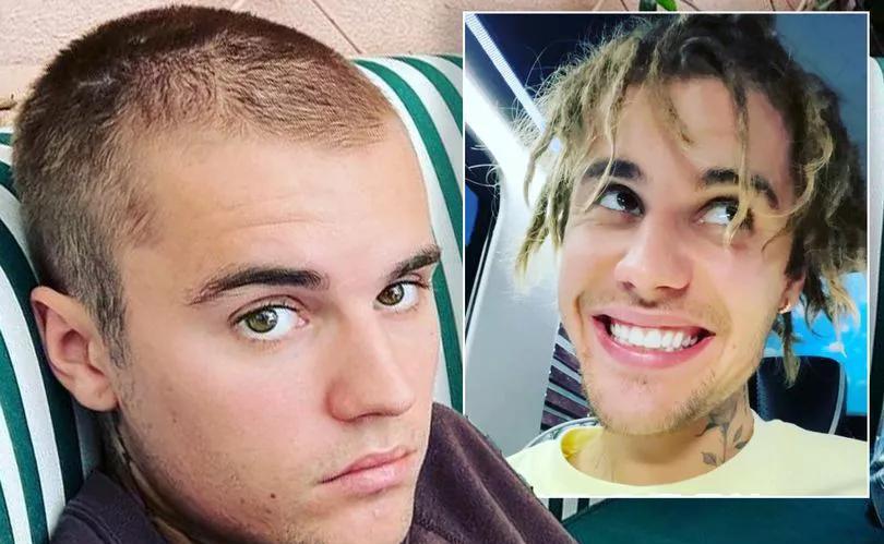 bieber)终于向粉丝低头,剪掉了广受批评的脏辫,改为一副标准的平头