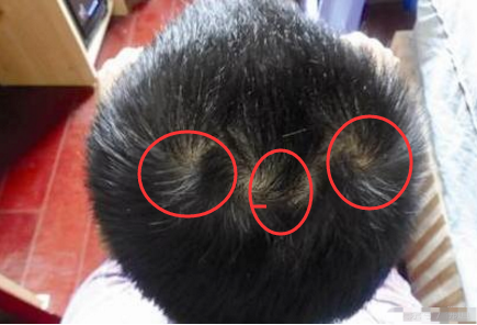 你的头上几个旋,几个旋好命,有什么意义?_腾讯新闻
