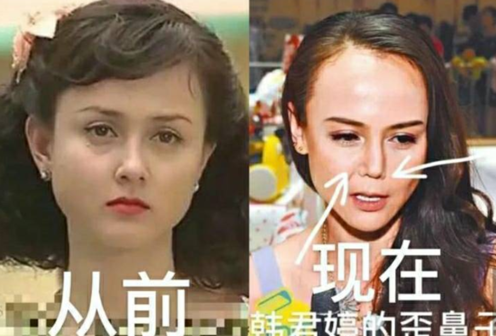 于是在那段时间,有关于韩君婷整容的新闻也相继播出,韩君婷整容的话题