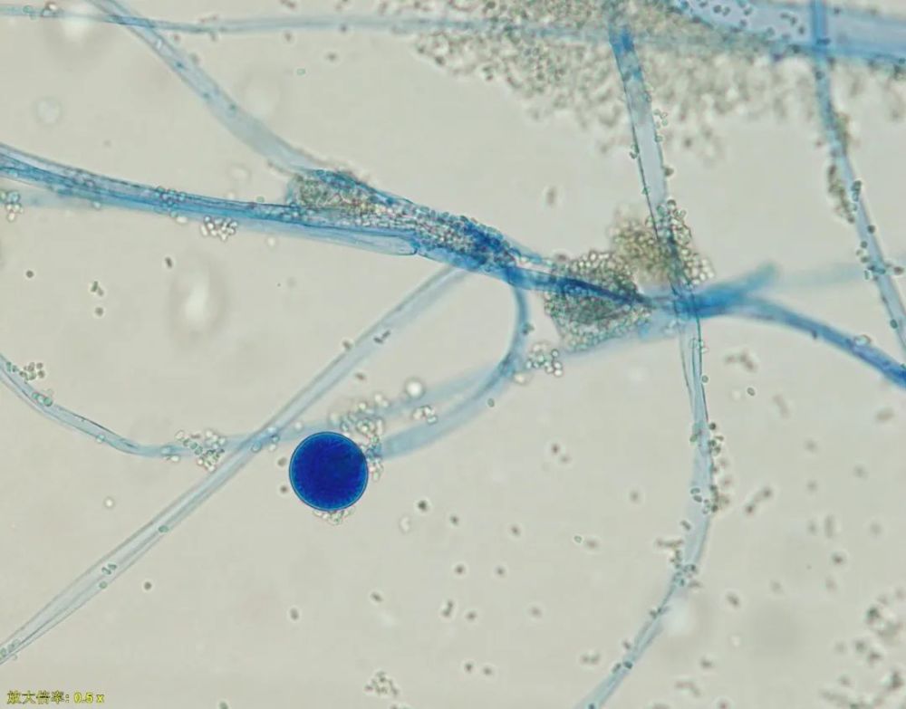 来源:网络培养基培养形态毛霉菌是一大类广泛存在于