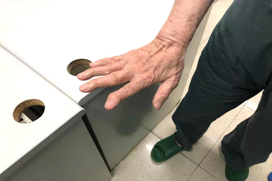 吴孟超院士握手术刀导致手指变形从医七十八载救下16万余人