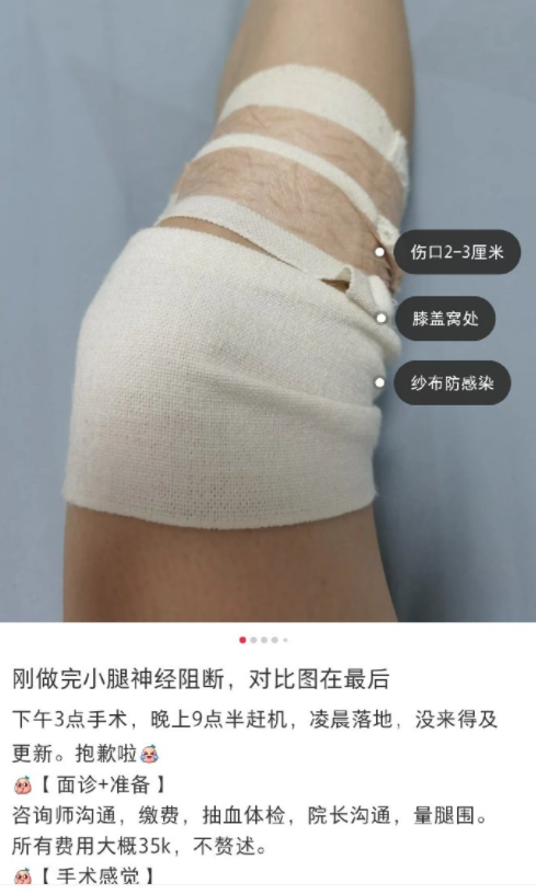 不要命 切胃拆肋骨 就为减肥 是谁在传播外貌焦虑 腾讯新闻