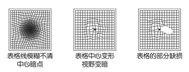 趣味眼部测试游戏带上孩子一起玩