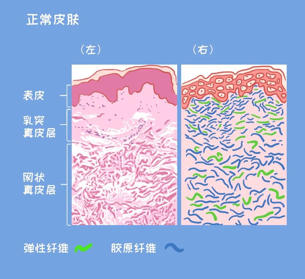 膨胀纹更容易形成会导致皮肤弹性下降另一种激素——松弛素的水平降低