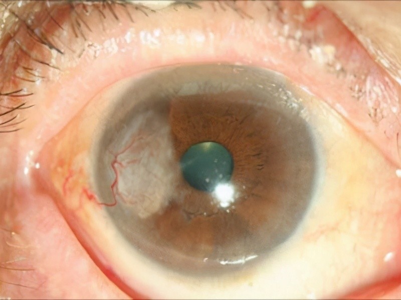 免疫治疗有些不良反应虽然罕见,但一旦出现也会引起严重后果_腾讯新闻