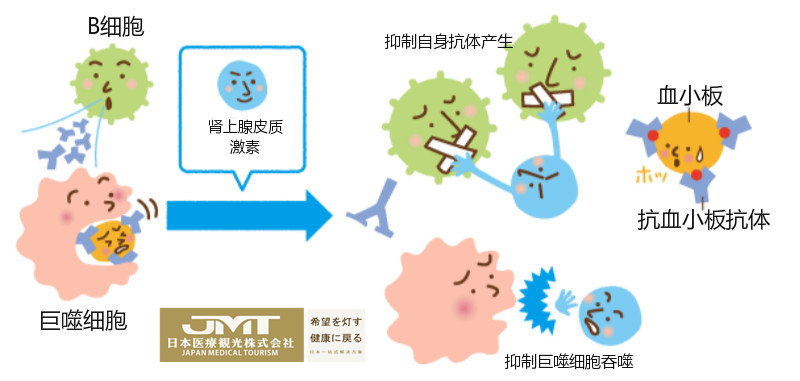 原發免疫性血小板減少症itp的日本治療