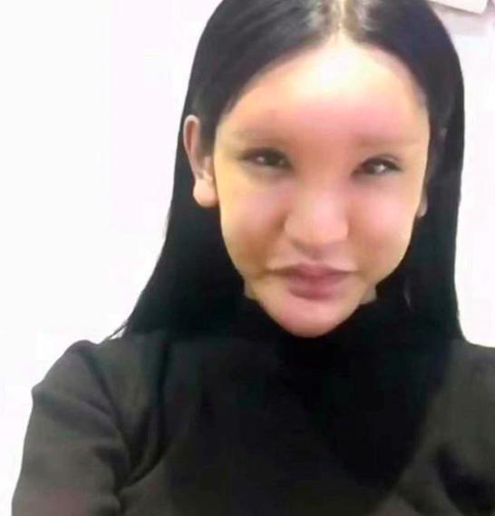 还记得女孩为了走红整容成蛇精脸?前后共花了85万,网友:没白花