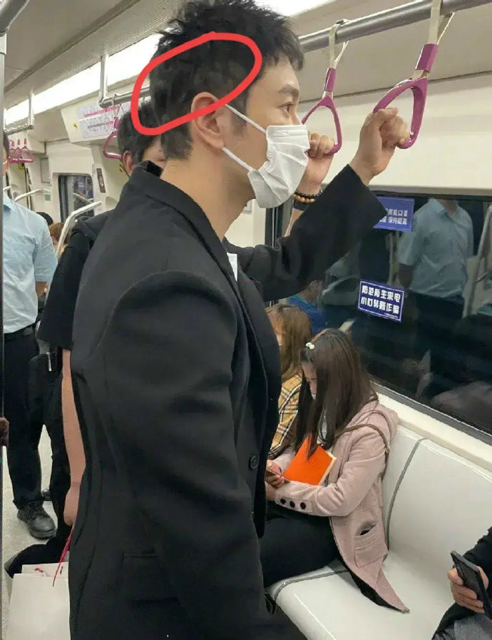 黄晓明也面临脱发难题?地铁生图曝光,说明问题!_腾讯新闻
