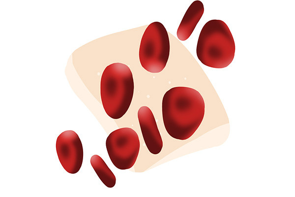阿司匹林可以预防血栓吗 阿司匹林的作用与功效 一文解释清楚 腾讯新闻