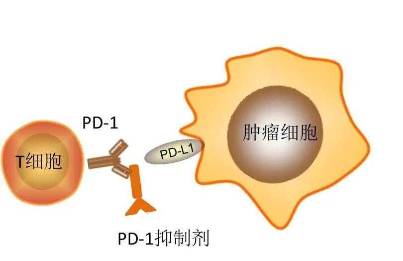 pd1pdl1與免疫細胞治療有什麼不同