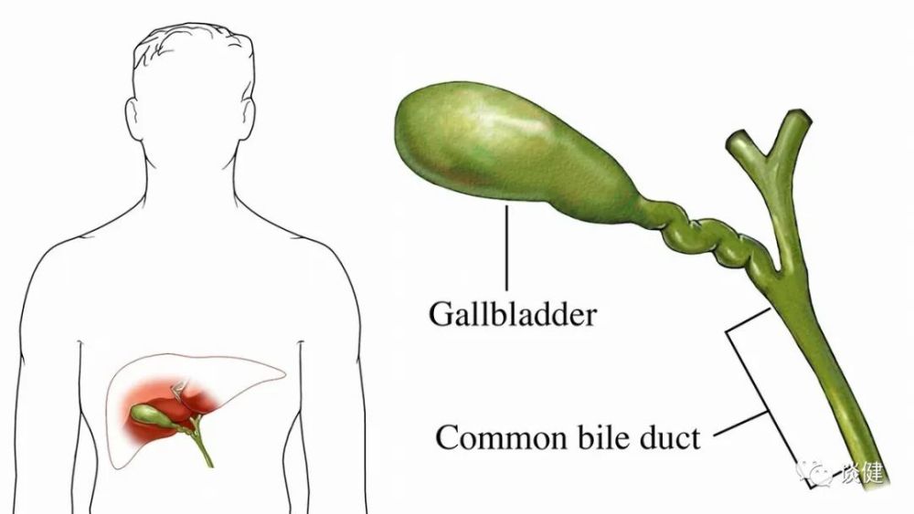 为什么需要胆囊切除胆囊切除会不会影响寿命医生一文说清
