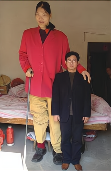 中国第一女巨人身高248米比姚明都高22厘米年仅18岁离世