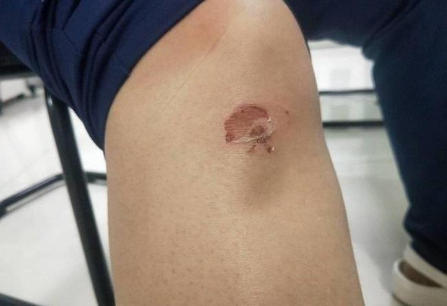 谢晓蕾这才感觉到跪了12分钟,已经磨破皮的膝盖在阵阵发痛