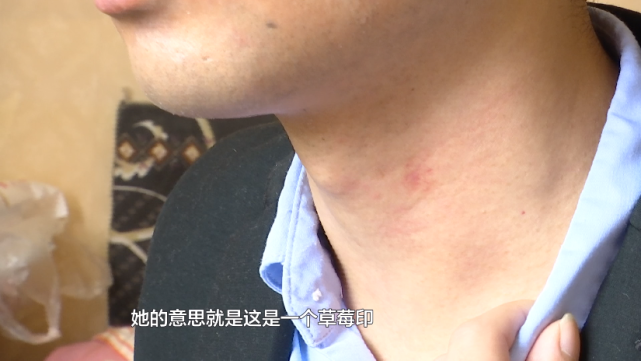 男子脖子上出现吻痕女友一怒之下要分手男子我这是睡出来的啊