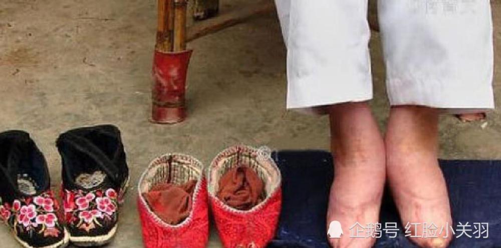 中国最后一位裹脚女性 15岁靠 三寸金莲 嫁大户 洗脚时钻心痛 腾讯新闻