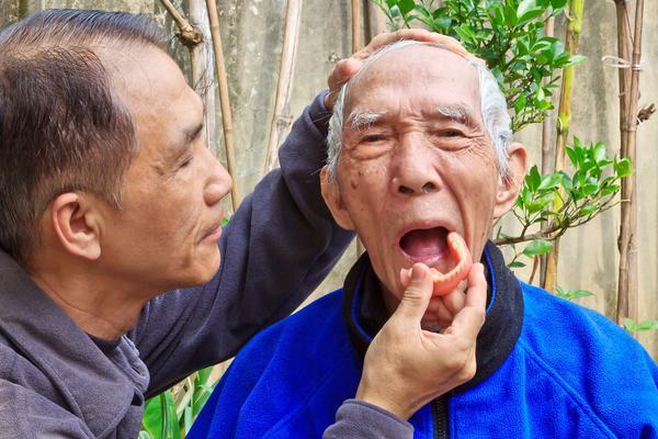 为什么年龄大了,容易掉牙?避免牙齿早早掉光,该怎么办