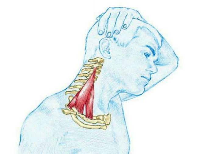 缓解颈椎,肩膀疼痛的拉伸方法之—斜角肌的拉伸