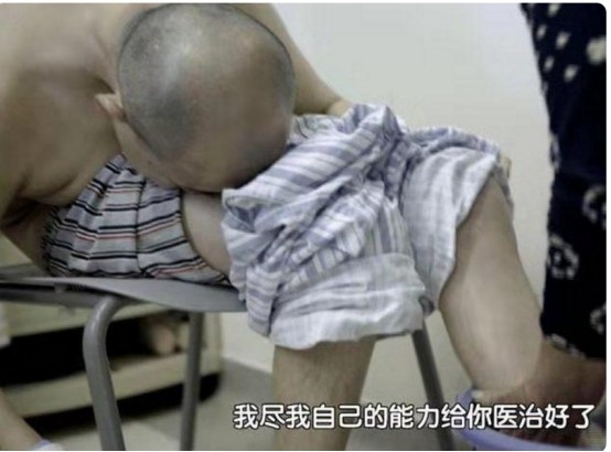 去年那个刷爆全网脊椎折叠28年的弯曲人李华如今怎样