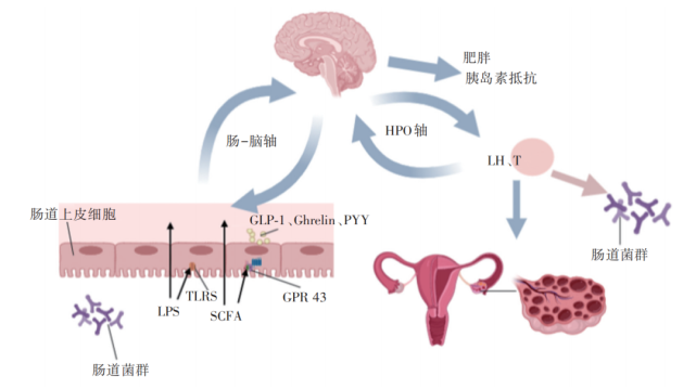 为什么肠道菌群失调与多囊卵巢综合征高雄激素血症,胰岛素抵抗,脂代谢