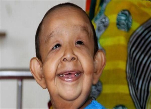 在古代近亲结婚很常见为何却很少生出智障儿原因其实很简单