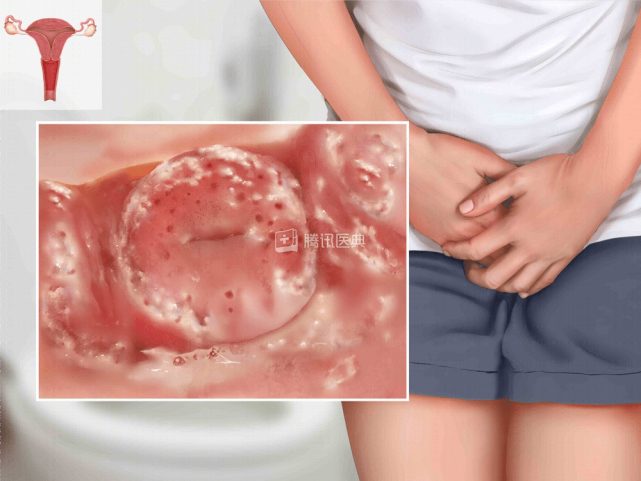 夫妻生活不和谐可能是妇科病作祟有这4种情况要抓紧看医生