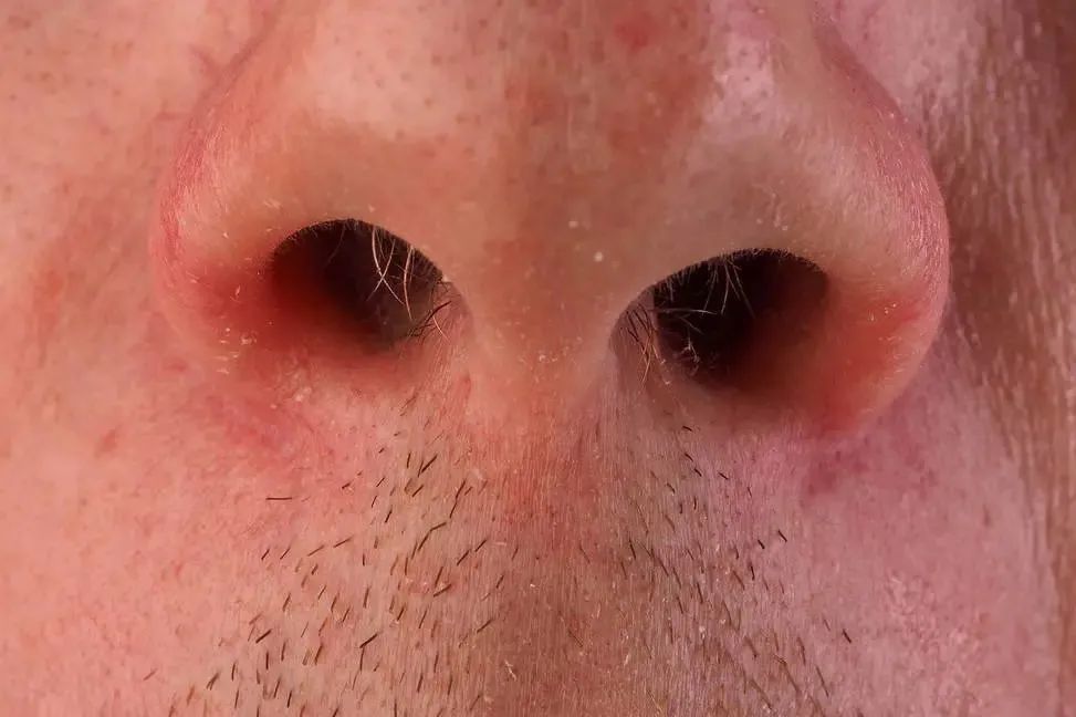 为什么人类会有鼻毛鼻毛浓密意味着什么这4点你要搞明白