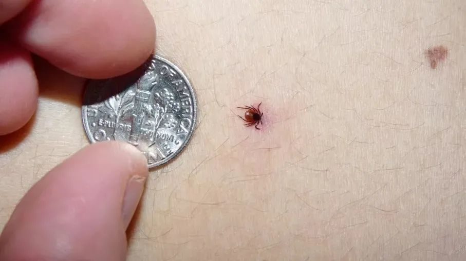 被这些虫子咬了可能会丧命夏季急救大全快收藏起来