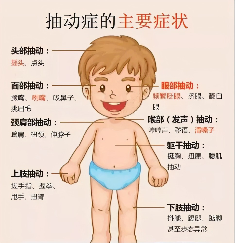 抽动症的症状先从面,颈部开始,逐渐向下蔓延.