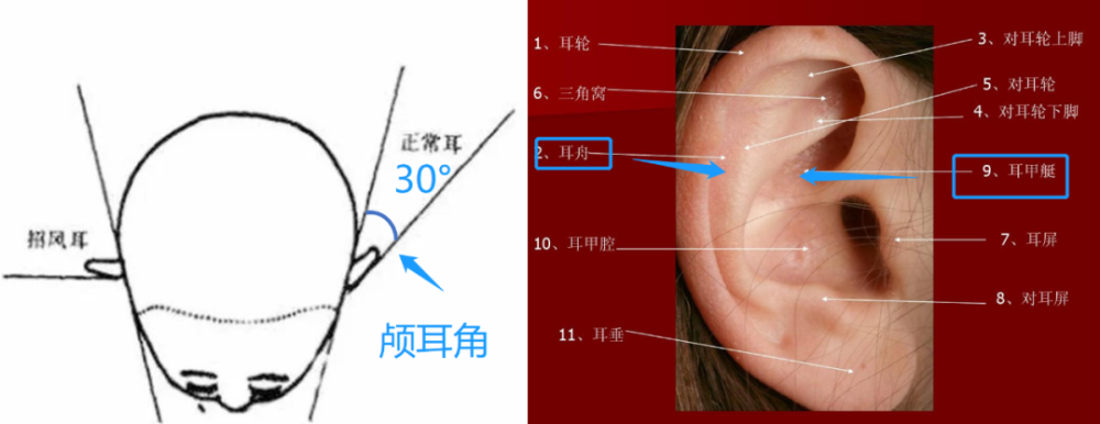 0成本,无痛,即刻拥有精灵耳?看完等于白赚20万…_腾讯新闻