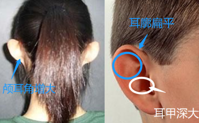 0成本无痛即刻拥有精灵耳看完等于白赚20万