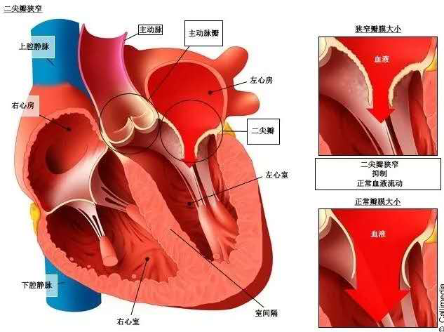 心脏瓣膜位置示意图图片