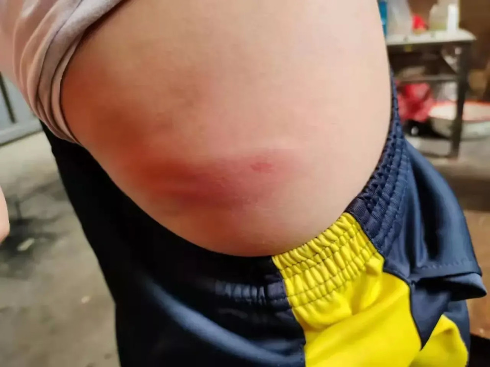 如果是个别孩子太调皮挨打,可能还能有个原因解析,但全班54名学生都挨