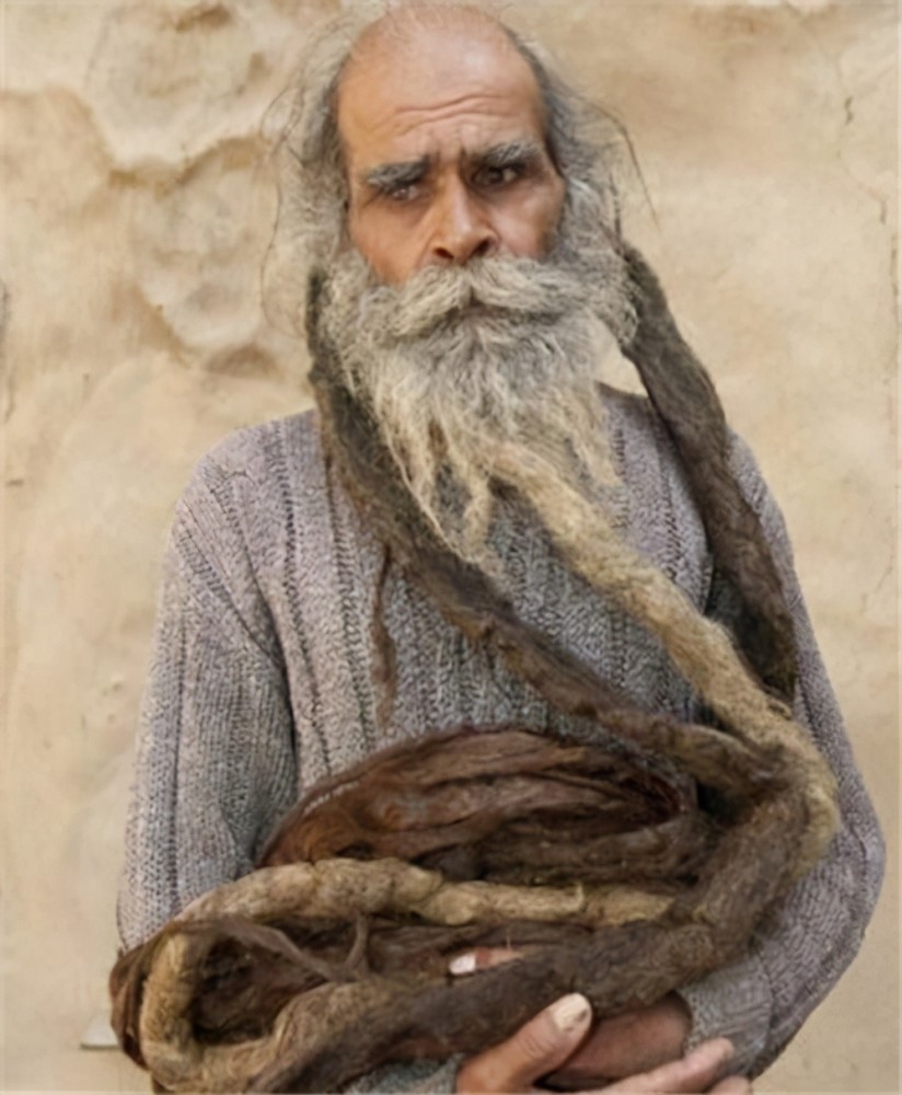 伊朗老人哈吉:因60年不洗澡打破吉尼斯纪录,身体像是穿了铠甲