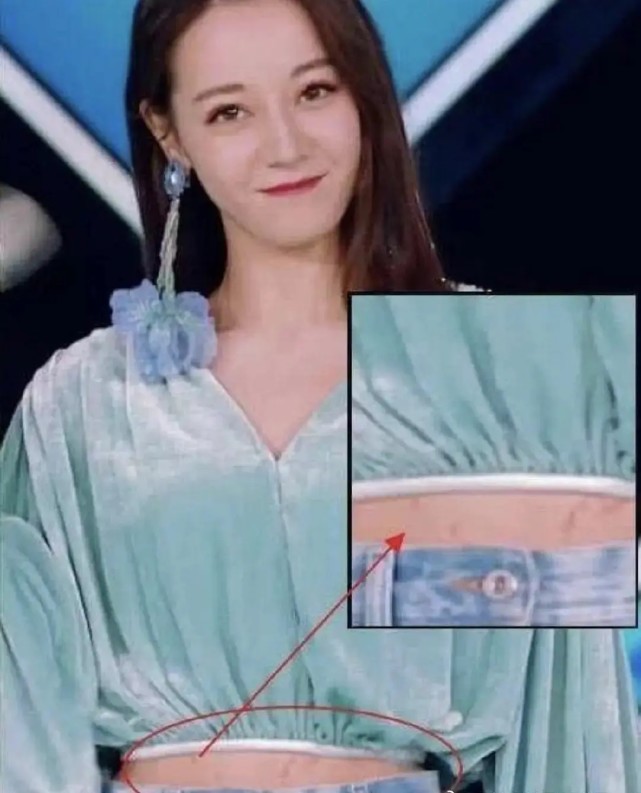 迪丽热巴肚子上有妊娠纹也有说是肥胖纹其实都不对那是伤疤